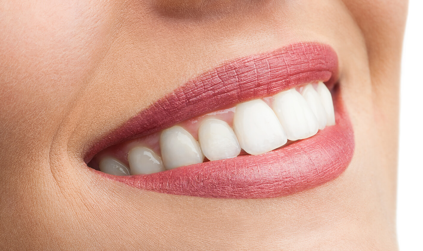 The Top Benefits of Veneers for Discolored Teeth