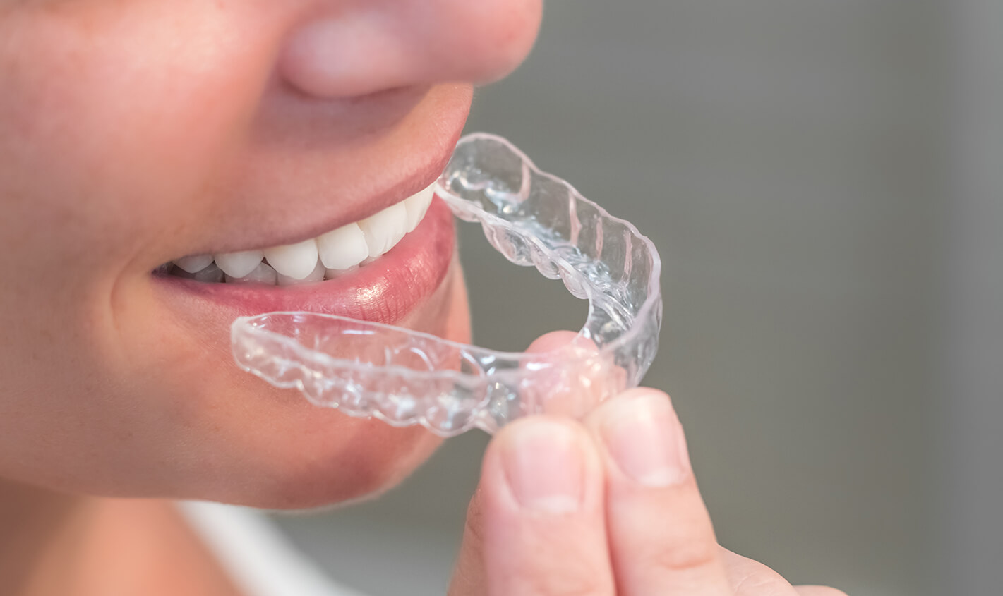 Invisalign Is A Leader In Clear Orthodontics, But What Sets It Apart From Competitors?